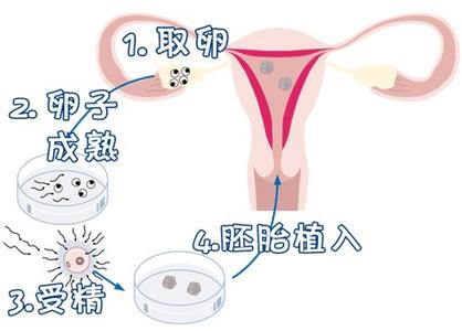 孕妈试管咨询服务代生儿子